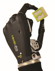 Handprothese mit Greifffunktion natürlicheren Bewegungsablauf